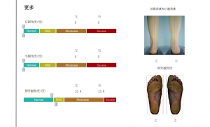 3D foot scanner