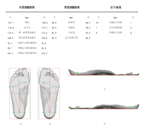 3D foot scanner