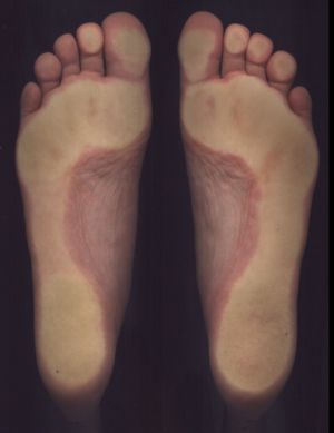 3D foot scanner